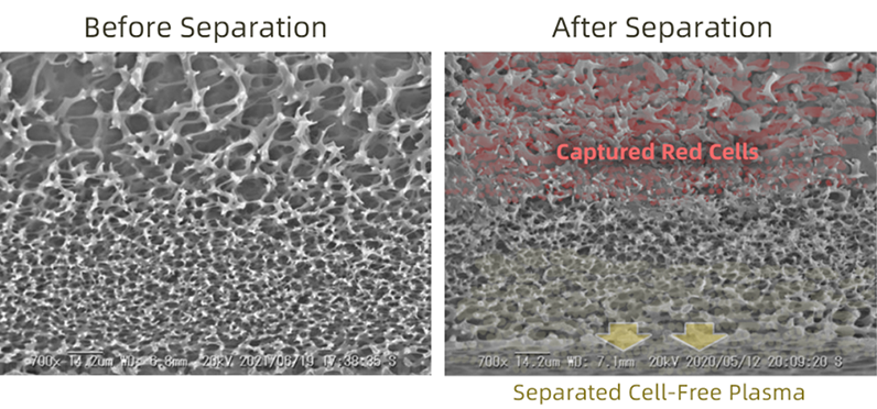 Plasma Separation by PSM Series Red Blood Cell Filter02-bct.png